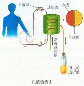 透析是为失去肾功能的人而进行的一种治疗方式,透析相当于人体内生理