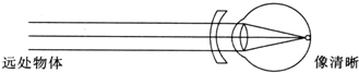 用凹透镜矫正的眼睛就是远视眼